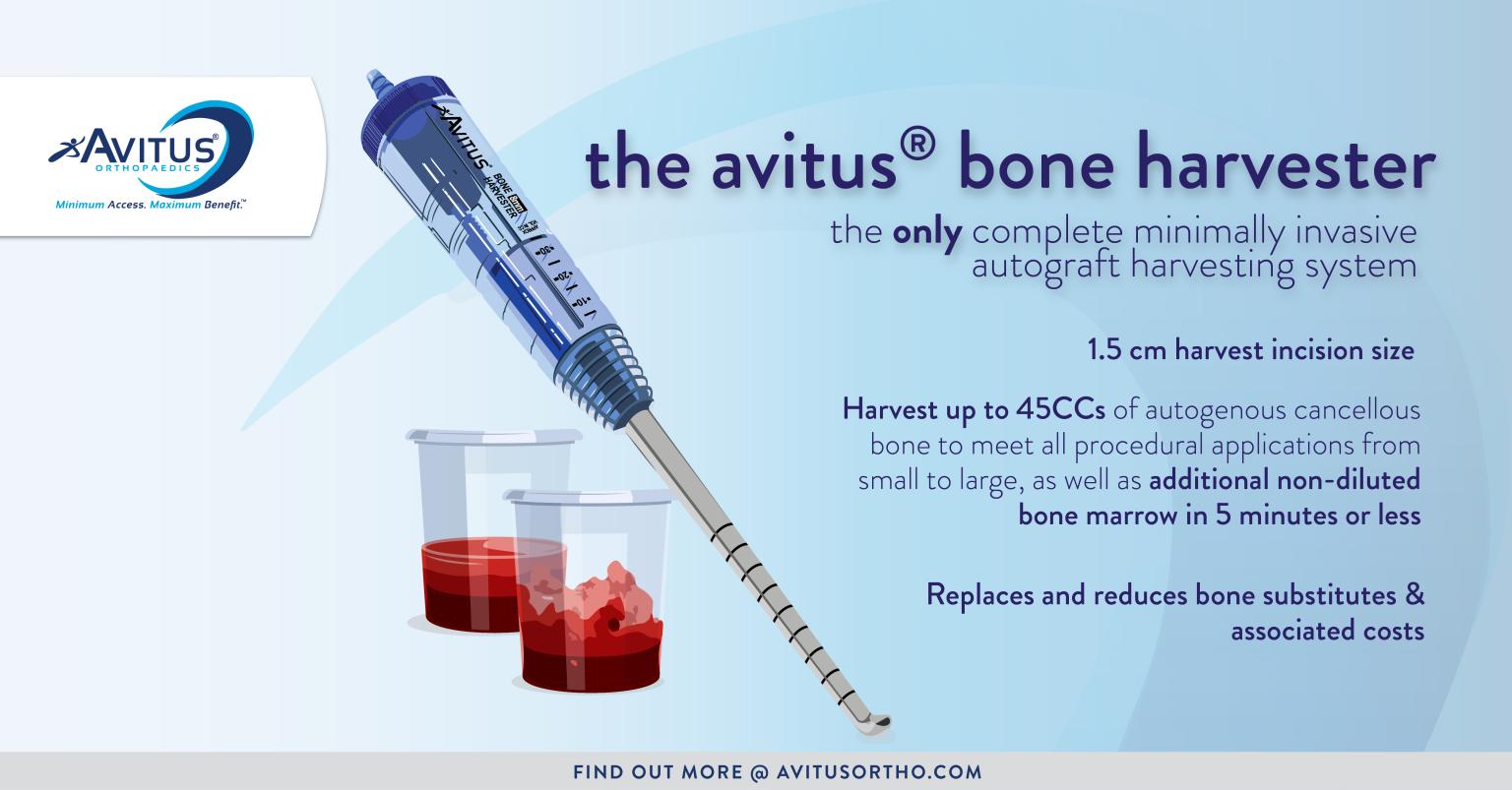 the avitus bone